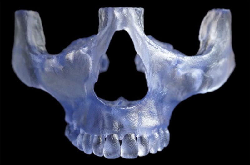 Zygomatic Maxilla Model